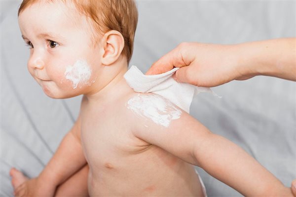 درمان خشکی پوست نوزاد در فصل‌های تابستان و زمستان