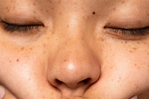 انواع پوست کدام‌اند: راهنمای گام‌به‌گام برای تشخیص نوع پوست
